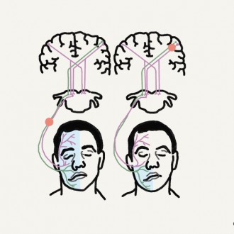 안면마비 구안와사