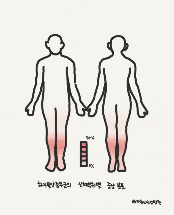 하지불안증후군