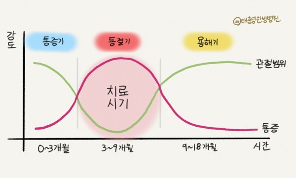 유착성관절낭염 오십견