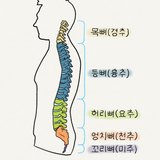 척추수술실패증후군