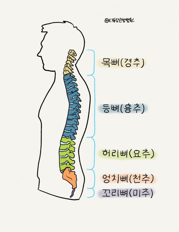 척추수술실패증후군