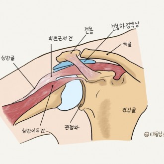 어깨 충돌 증후군