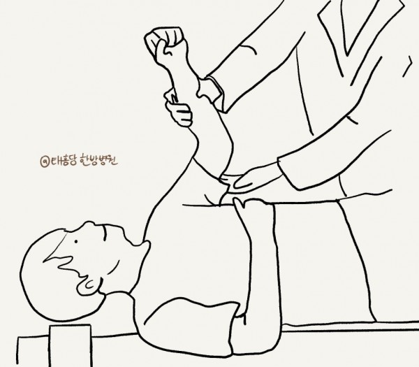 어깨 충돌 증후군