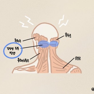 긴장성 두통&nbsp;