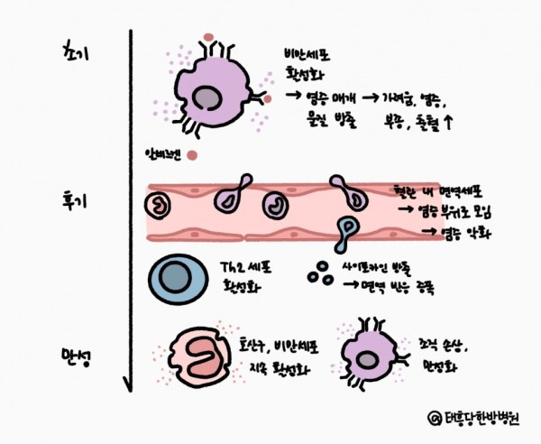 알레르기 비염