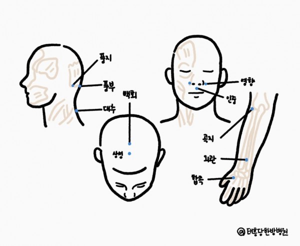알레르기 비염