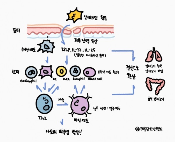 알레르기 아토피