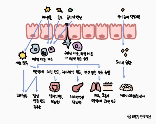 만성피로 장누수증후군