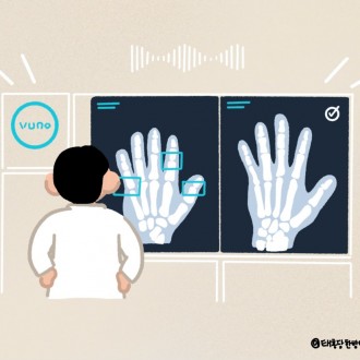 성장검사 뷰노Ai