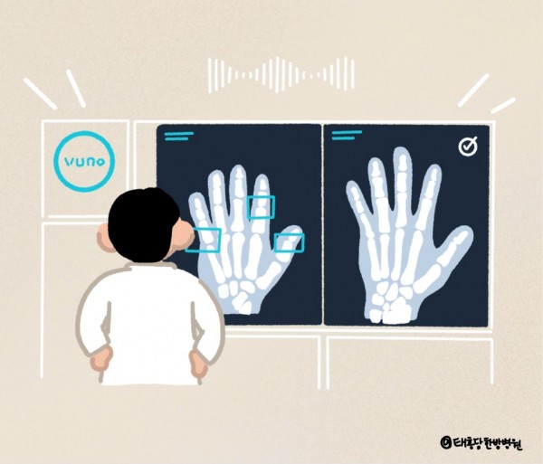 성장검사 뷰노Ai