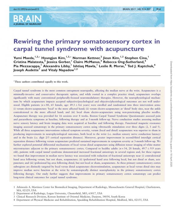 하버드 대학교 및 국내 연구진 공동 연구, 손목터널증후군(Carpal Tunnel Syndrome, CTS)과 침치료